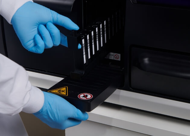 LIAISON® XS Analyzer: A High-Tech Solution For Immunochemistry Tests - Diasorin
