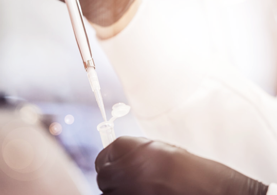 Webinar: Improving Rheumatoid Arthritis Diagnostics with Multiplex Assays